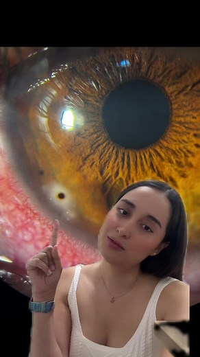Cuidado con las Rebabas en los Ojos: Prevención y Consejos