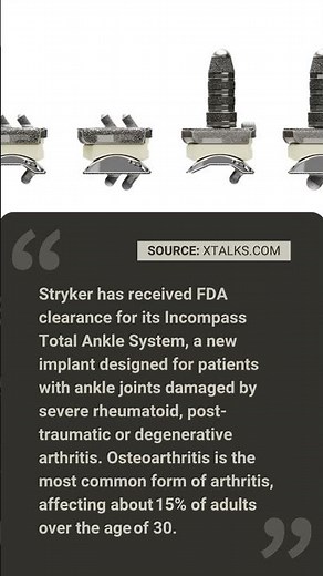New Total Ankle Replacement System from Stryker Gets FDA Clearance