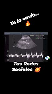 Te aseguro que no sabías esto...💥 "Consulta con Ginecóloga Eco Obstétrico"... ❤️ Por tiempo limitado...⏰ De $850 pesos a solo $399 pesos. 🔥 Manda un mensaje el día de hoy...⏱️ Pide la promoción, no la pierdas... 🎁 Aplica Restricciones** | DepoDental Plus