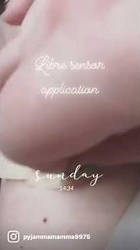 Freestyle libre application to thigh