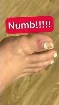 Do they numb you for ingrown toenail removal?? 🤔 #shorts