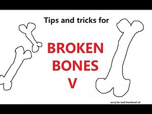 Broken Bones 5 Tips and Tricks