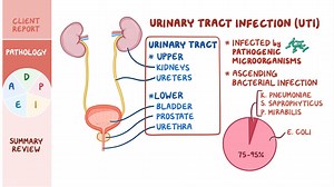 Video: Urinary tract infections (UTIs): Nursing process (ADPIE) - Video Explanation! | Osmosis | Osmosis