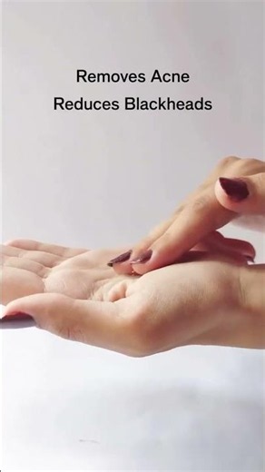 Breakouts don’t improve with just cleansing #simplistskincare #skincare #salicylicacid