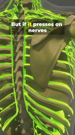 Extra Neck Ribs. Real Thing: Anatomy Surprise!!! #tiktok