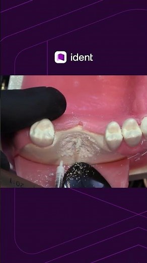 The step that changes your bone reconstruction