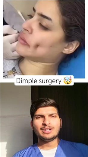 Dimple surgery 🤯 #dimple #surgery #healthtips #shorts