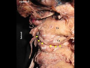 Third Occipital Nerve & Cervical Medial Branch Block