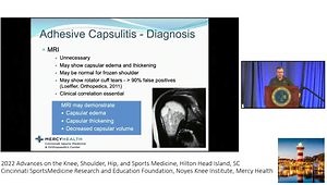 Shoulder Stiffness: 2022 Update