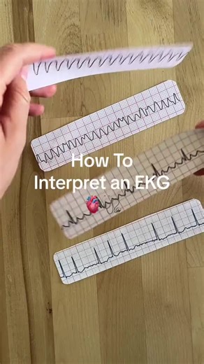 Reading EKGs made simple 💓 Learn the basics in seconds! #NurseTok #EKGInterpretation #NurseTok #MedTok #NursingStudent