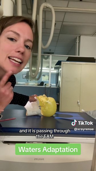 Radiology Student Learning X-ray Skull Positioning at CLXT NAIT