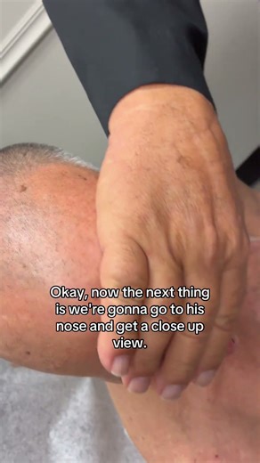 Dermatologist with 50 years experience shows different mole types on patient 👨🏻‍⚕️