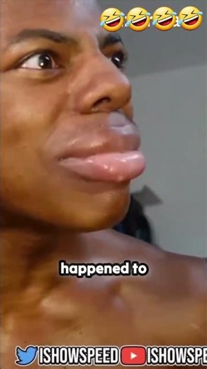 ishowspeed LIPS ARE PERMANENTLYSWOLLEN after this stupid challenge!