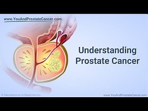 Understanding Prostate Cancer