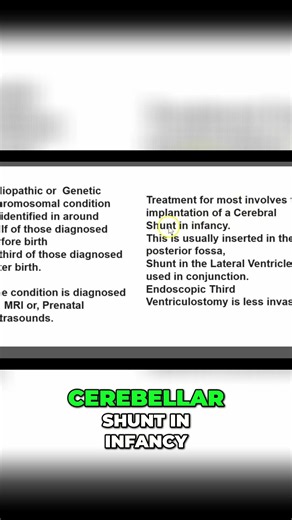 Cerebellar Shunt: Understanding the Diagnosis and Treatment #shorts