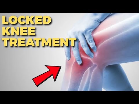 Locked Knee Treatment Best Tips (No Surgery Required)