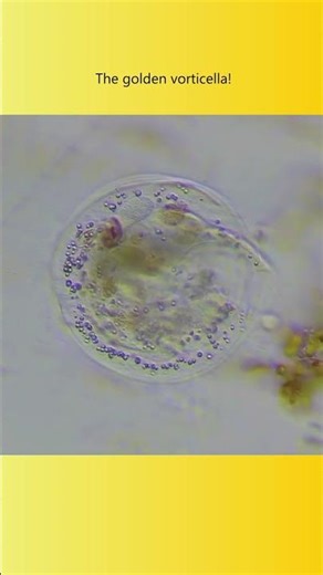 The golden vorticella! #microscopy #biology #science #nature