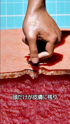 ダニに噛まれたときの対処法