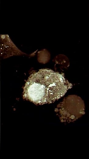 Watch a Cancer Cell Self-Destruct | Apoptosis in Action #cbse12thbiology #anatomy #trending #shorts