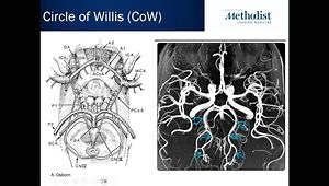 Neuroradiology: CTA for Stroke and Aneurysm Case Studies