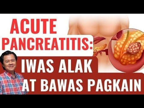 Acute Pancreatitis: Iwas Alak at Bawas Pagkain. - By Doc Willie Ong (Internist and Cardiologist)