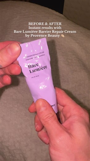 Dehydrated and irritated skin? 😫 My damaged skin barrier was screaming for help! I've been using the best barrier repair cream, recommended by my dermatologist, and I'm already seeing a huge difference. Check out Bare Lumiere Barrier Repair Cream! @Provence Beauty #barrierrepair #barrierrepaircream