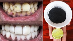 In just two minutes Charcoal teeth whitening toothpaste this recipe treatment at home | Natural Health