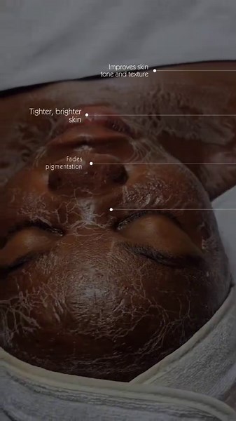 #CapCut Probiotic Enzyme Facial – Price: 130,000 Tsh ✨ Benefits: • Gently exfoliates dead skin cells • Helps reduce acne and breakouts • Balances the skin’s natural bacteria • Improves skin texture and smoothness • Brightens and evens skin tone • Helps unclog pores and reduce blackheads • Leaves the skin hydrated, fresh, and glowing Book your session today 📞 0749 390 267 📍 Medeli Street near Shoppers Plaza, Dodoma Dodoma Wellness Center and Spa 💆🏾‍♀️