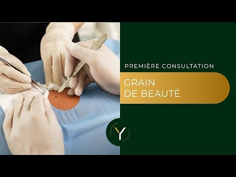 Grain de beauté