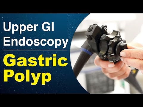 Upper GI Endoscopy - Gastric Polyp