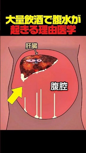 大量飲酒で腹水が起きる理由【医学】