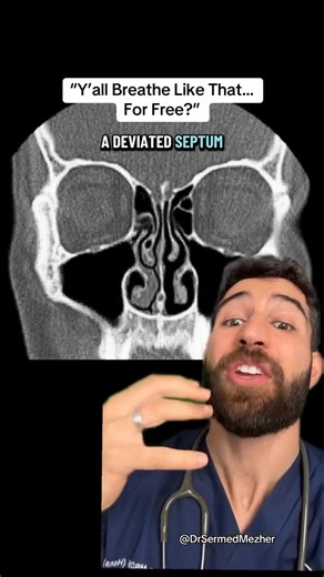 A deviated septum happens when the thin wall that divides the two sides of your nose is crooked or shifted off-center. For many people, this makes one nasal passage smaller, which can cause blocked breathing, snoring, or a feeling of constant congestion on one side — even when there’s no cold or allergy. Getting a septoplasty, the surgery to repair a deviated septum, can make a big difference. By straightening the septum and clearing the airflow path, air can move more freely through both nostri