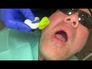 Placing the Releaf Dental Suction