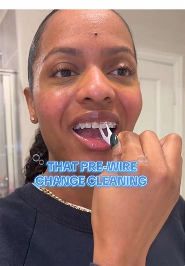 Keeping Your Braces Clean: Tips for Spotless Teeth