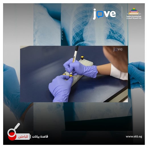 Learning through interactive, informative videos can make the learning process totally different. JoVE now provides explanatory videos in various scientific fields and in several languages. The following collection highlights some of the latest protocols in lung cancer research all available to you though the Egyptian Knowledge Bank: https://www.ekb.eg/ar/bridge-to-url?redirect=https://bit.ly/3FB9R8Z التعلم من خلال مقاطع الفيديو التفاعلية والغنية بالمعلومات يمكن أن يجعل عملية التعلم مختلفة تماما