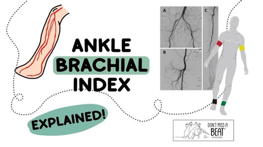 Ankle BRACHIAL Index - EXPLAINED | Don t Miss A Beat