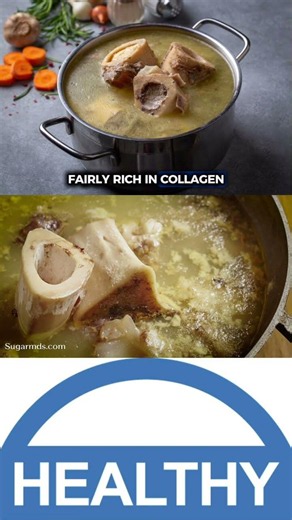 Bone broth is doing more healing than you think 🍲