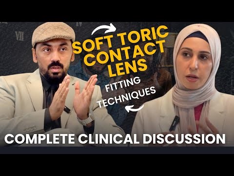 Soft Toric Contact Lens Fitting + LARS Rule | Clinical Discussion