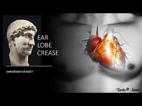 Ear Lobe Crease: What does it mean?