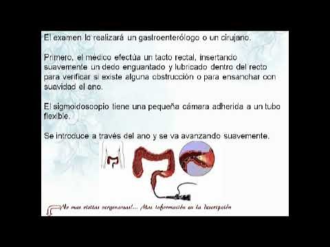 Rectosigmoidoscopia