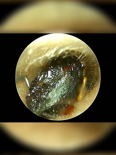 Ear Cleaning ASMR Hacks for a Fresh Experience