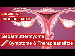 Myome: Prof. Dr. Hadji über moderne Therapien