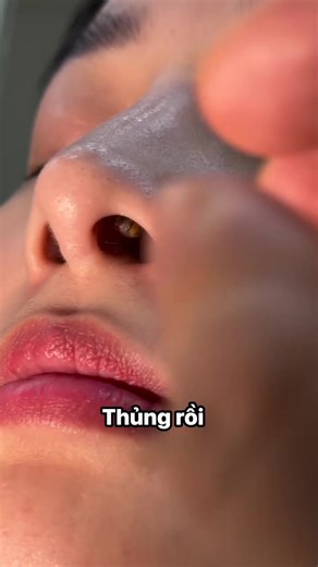 76K views · 61 reactions |  It looked small, but wait till you see the ending! #drpimplepopper #grossaddiction | Pimple Popping | Facebook