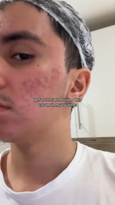 Finally BACK IN STOCK🔥 Grab yours before sold out! Meet Trendy K-beauty Itema at K-SECRET✨ Dr. Althea X KSECRET, Don’t miss out on this amazing deal! Treat yourself to the ultimate K-beauty experience! Stock up now on your favorite K-beauty items before it’s too late. 🛒💖 Shop Now: https://bit.ly/4gIb4fT 🎉GET EXTRA 25% OFF 🎯 Use Code ➡️ USE CODE : EID25🎁 With TAMARA & TABBY, pay in 4 installments! Your authentic K-Beauty destination, K-Secret. | K-Secret