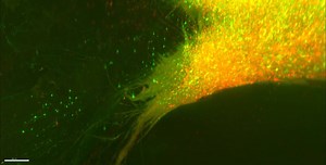 File:Whole-brain-3D-mapping-of-human-neural-transplant-innervation-ncomms14162-s2.ogv - Wikimedia Commons