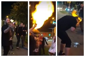 Stunt Goes Horribly Wrong Leaving Man’s Entire Face On Fire: Horrific Video Emerges