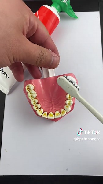 I finally found this,sp10 probiotic toothpaste has the maximum whitening effect without damaging tooth enamel, making your smile whiter! #toothpaste #fyp #badbreath #whiteningteeth #yellowteeth #foryou #fpy #capcut #foryoupage #tiktok #tiktokshop #tiktokmademebuyit