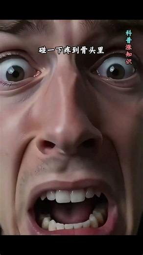 第399集：像假髮的貓毛蟲，北美最毒的毛毛蟲之一，你敢摸嗎？ 科普漲知識：貓毛蟲是什麼？北美地區南方絨蛾的幼蟲，身披「假髮」般的毛，其實是毒刺，碰一下痛到骨頭裡。 #貓毛蟲 #毛毛蟲#毛蟲#