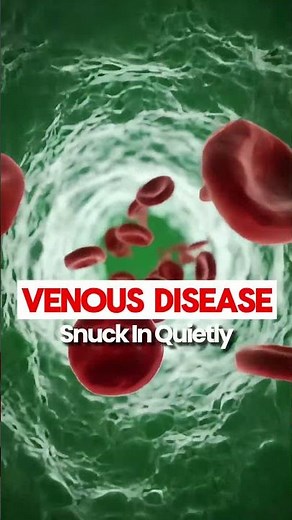 Red Blotchy Legs After Walking? It’s Not Sunburn — It Could Be Venous Disease