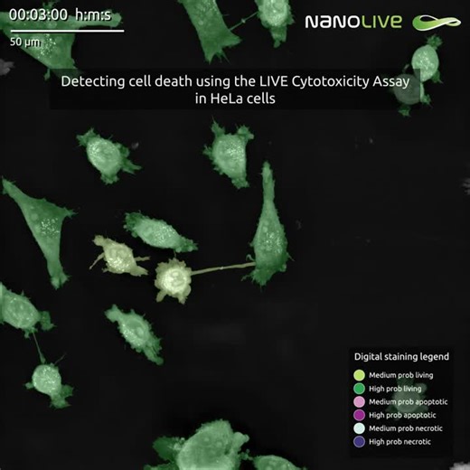 Nanolive detects apoptosis and necrosis with AI-powered label-free assay | Nanolive SA posted on the topic | LinkedIn